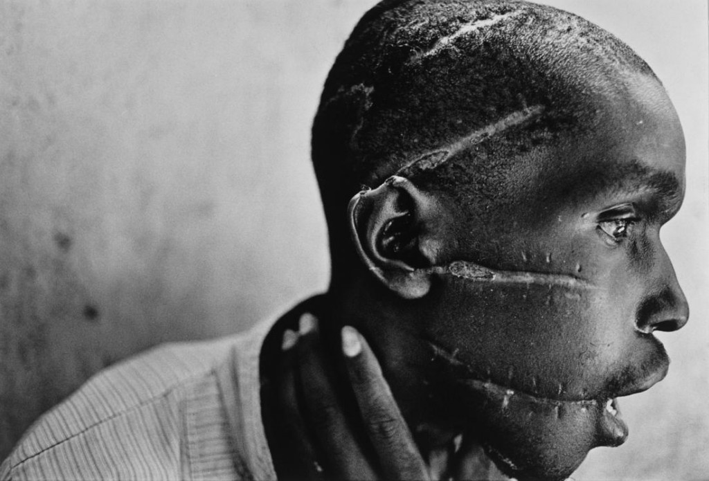 1995: Esta fotografía retrata los efectos del genocidio en Ruanda sobre sus sobrevivientes. Foto: James Nachtwey.