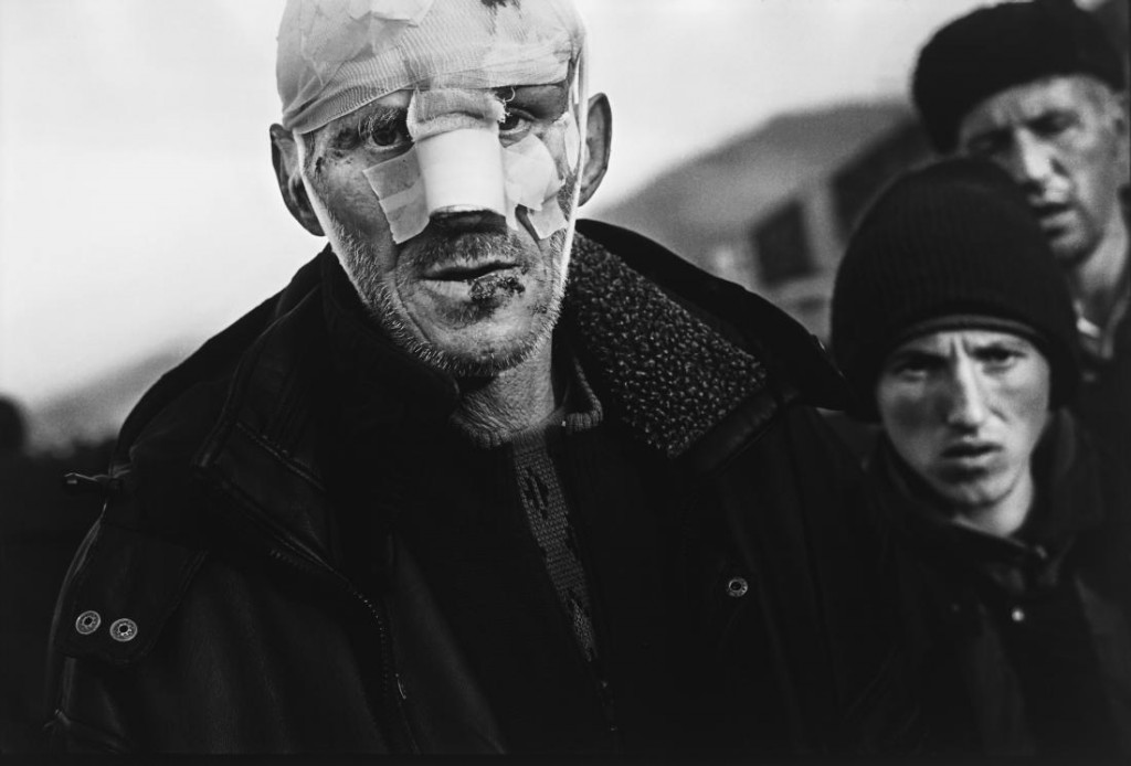 1999: Un hombre herido viaja con un grupo de albanos que abandonan Kosovo, tras los bombardeos de la OTAN. Foto: Claus Bjørn Larsen.