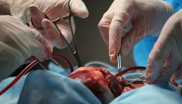  Hubo 63% menos trasplantes de órganos que en 2019: Asociación Ale