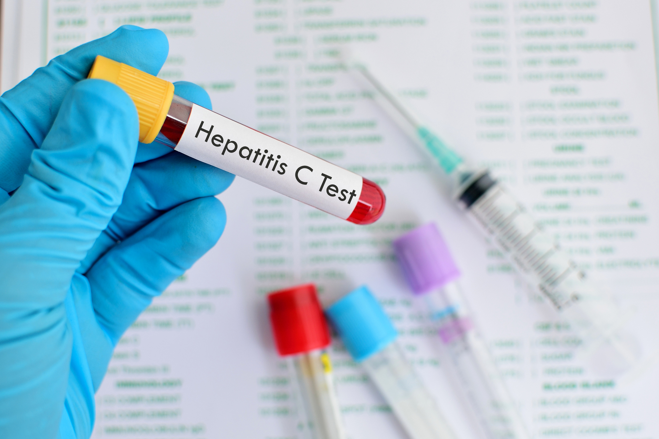  Solo 12 países en el mundo se encaminan a eliminar hepatitis C para 2030
