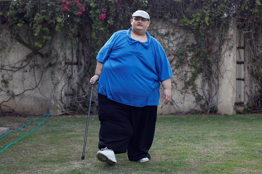  Con 334 kilos menos, el jaliciense Juan Pedro deja de ser el hombre “más obeso del mundo”