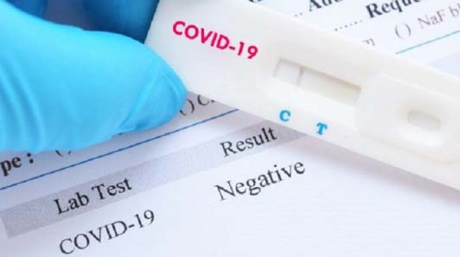  Para garantinzar seguridad en transplantes, Asociación ALE adoptaría pruebas rápidas para dectectar COVID-19