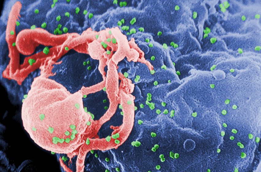  Por recortes y pandemia de COVID-19, pruebas para detección de VIH cayeron hasta 59%