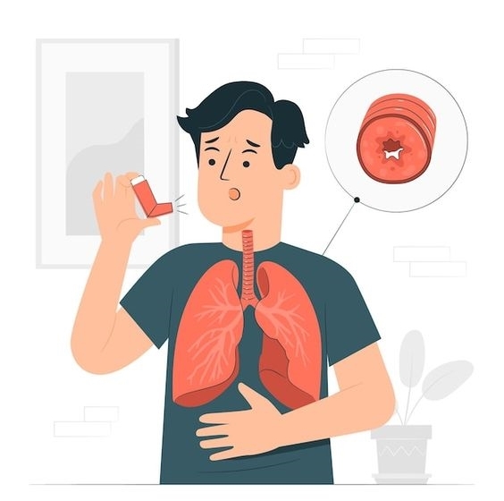  El asma puede ser confundido con otros padecimientos: SESA