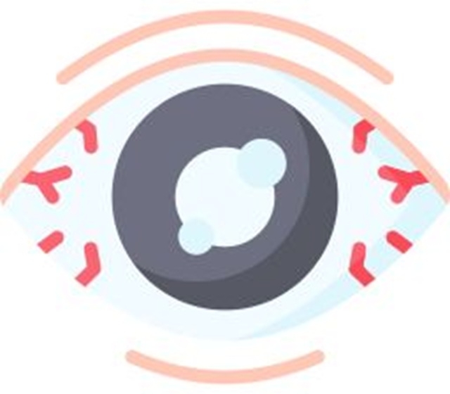  Secretaría de Salud de Querétaro promueve la detección temprana del glaucoma